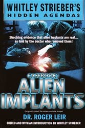 Casebook: Alien Implants | Free Book